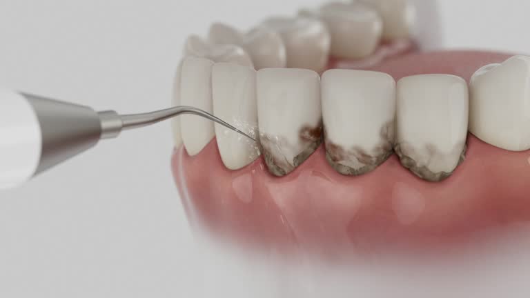 Trusted Dental Crowns And Bridges service in Grand Point, LA - Dentist Open Now